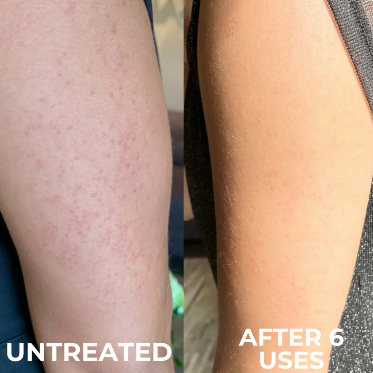 Vertex Resurface Cream™