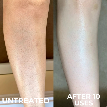 Vertex Resurface Cream™
