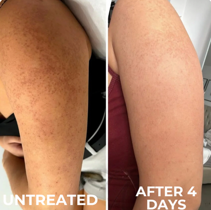Vertex Resurface Cream™
